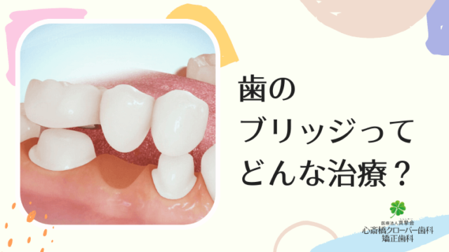歯のブリッジってどんな治療？